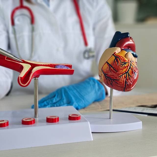 Tromboza: cauze, simptome, diagnostic, tratament