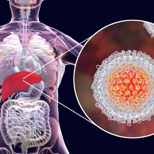 Hepatita C, afecțiunea care se transmite prin sânge